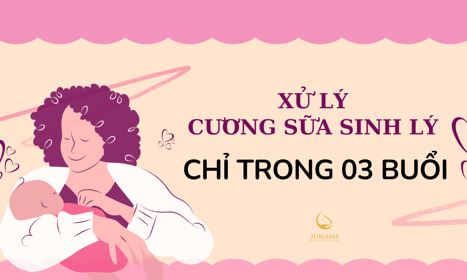 Xử lý Cương sữa sinh lý chỉ trong 03 buổi